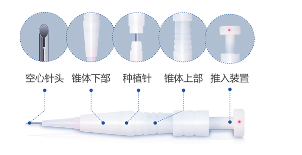 告别脱发造成的“初老症”，选择正宗大麦微针植发技术